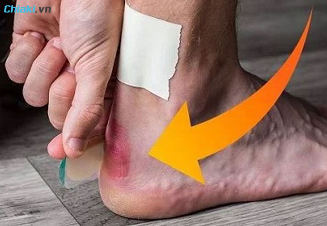 T&aacute;c hại khi đi gi&agrave;y da cứng thường xuy&ecirc;n