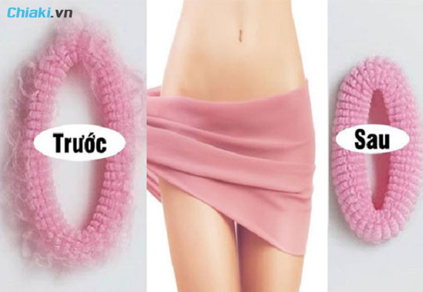 Tại sao cần sử dụng vi&ecirc;n đặt se kh&iacute;t v&ugrave;ng k&iacute;n?