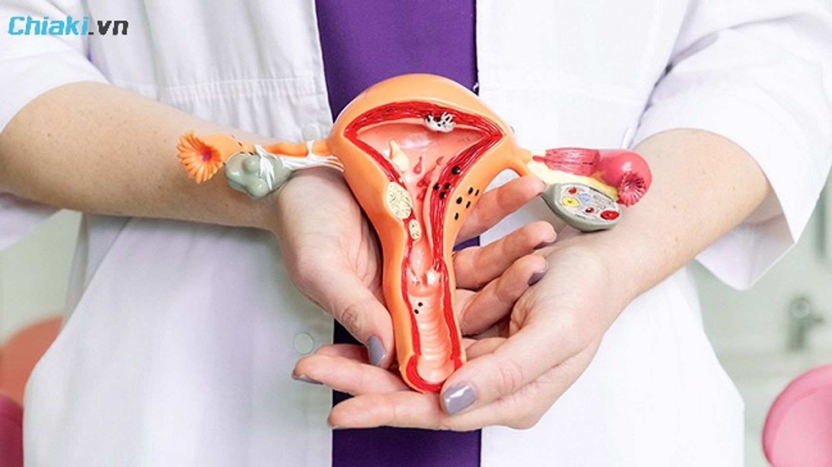 Nhiều nguy&ecirc;n nh&acirc;n g&acirc;y n&ecirc;n t&igrave;nh trạng vi&ecirc;m &acirc;m đạo