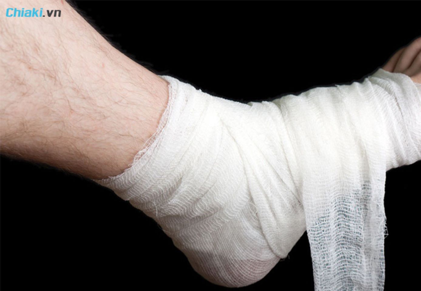 Một số c&aacute;ch trị nứt g&oacute;t ch&acirc;n kh&aacute;c