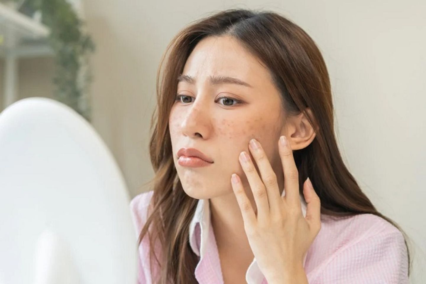 Ti&ecirc;u ch&iacute; lựa chọn kem trị n&aacute;m hiệu quả