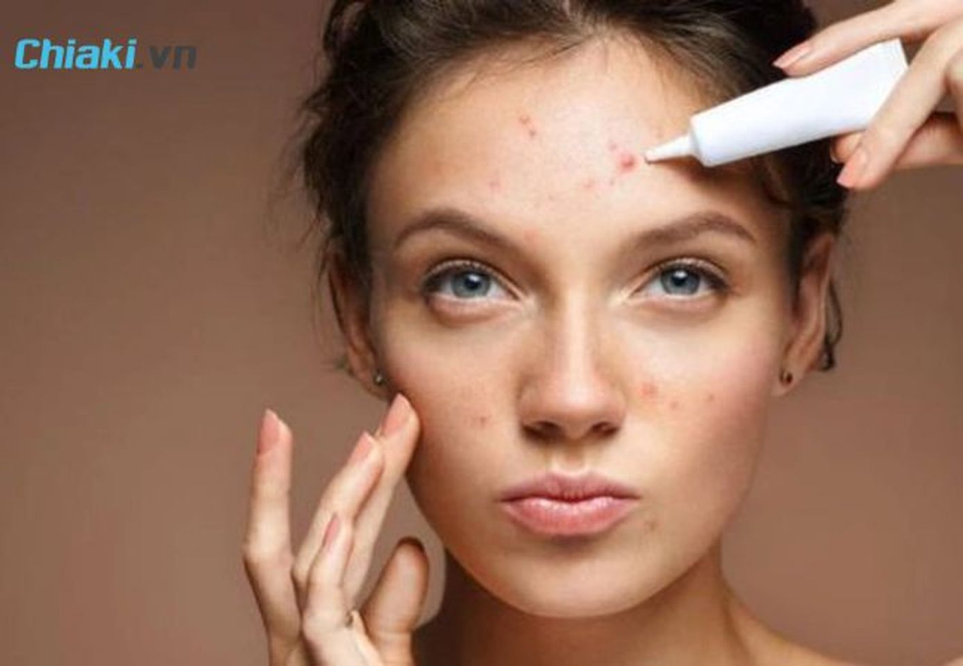 ưu điểm của c&aacute;c loại kem trị mụn ẩn