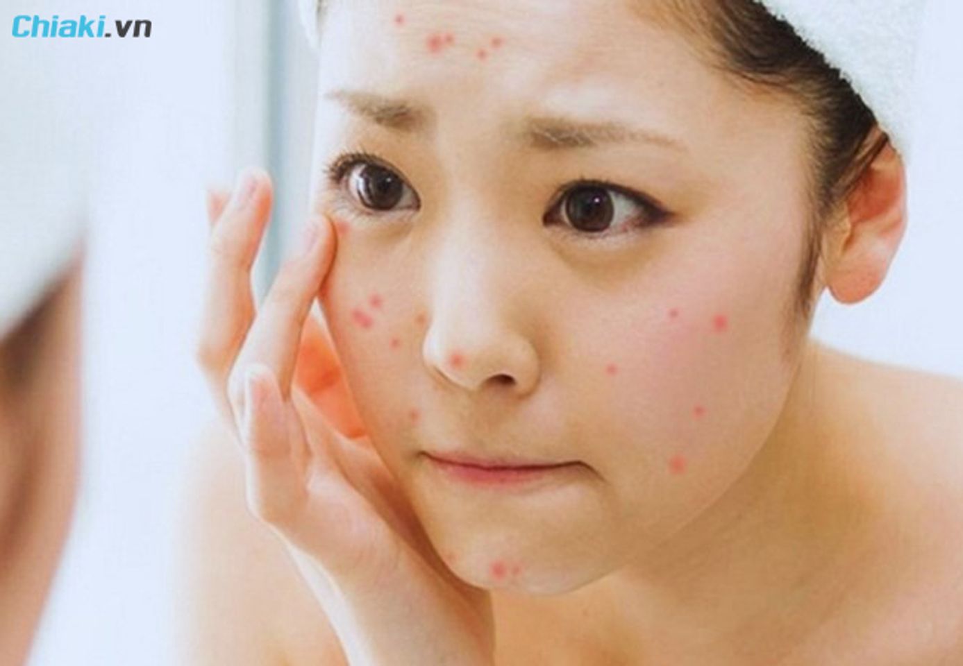 Những t&aacute;c hại của kem chống nắng đối với l&agrave;n da