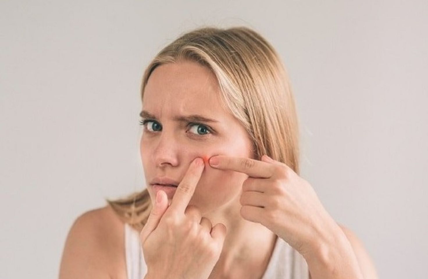 Tầm quan trọng của việc chăm s&oacute;c da sau khi nặn mụn