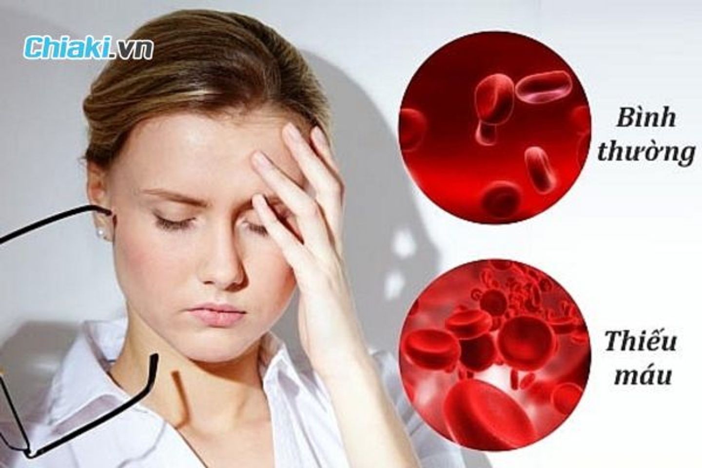 Thuốc sắt cho người thiếu m&aacute;u n&atilde;o gi&uacute;p hỗ trợ giảm đau đầu, ch&oacute;ng mặt