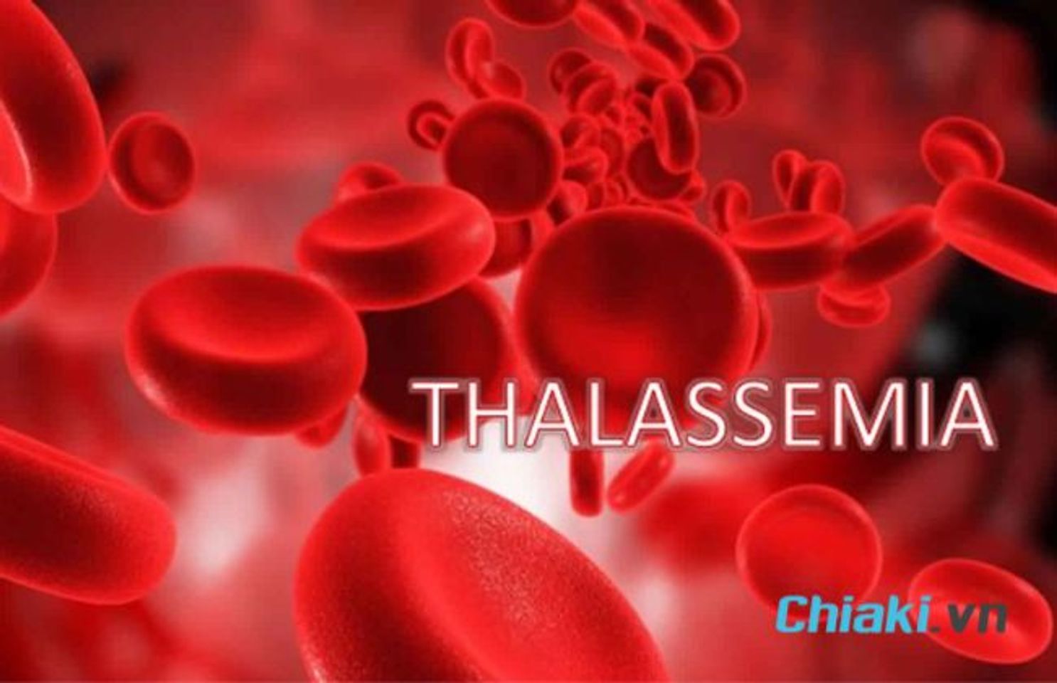 Bệnh Thalassemia l&agrave; g&igrave;