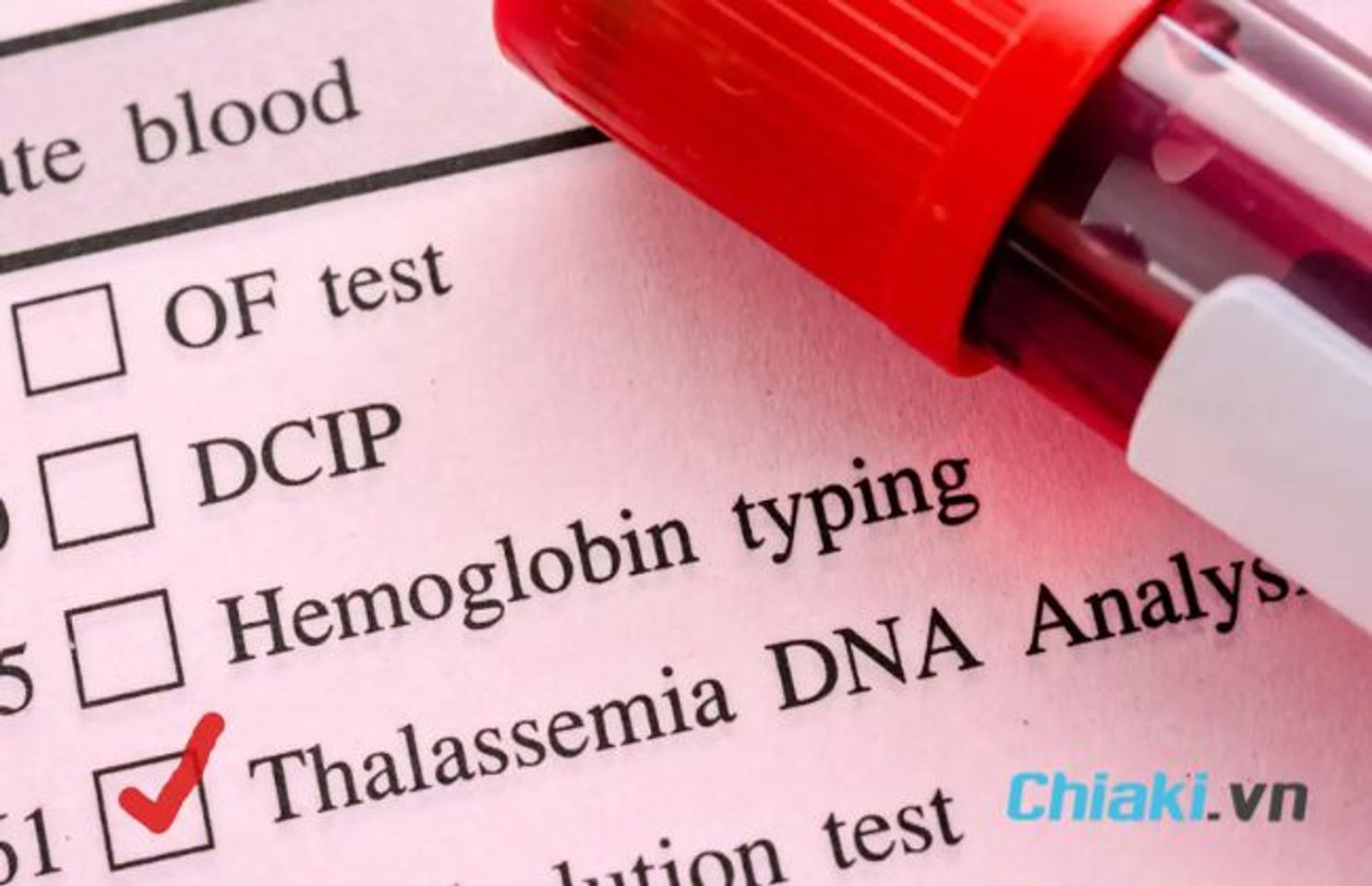 C&aacute;ch bổ sung sắt người mang gen Thalassemia