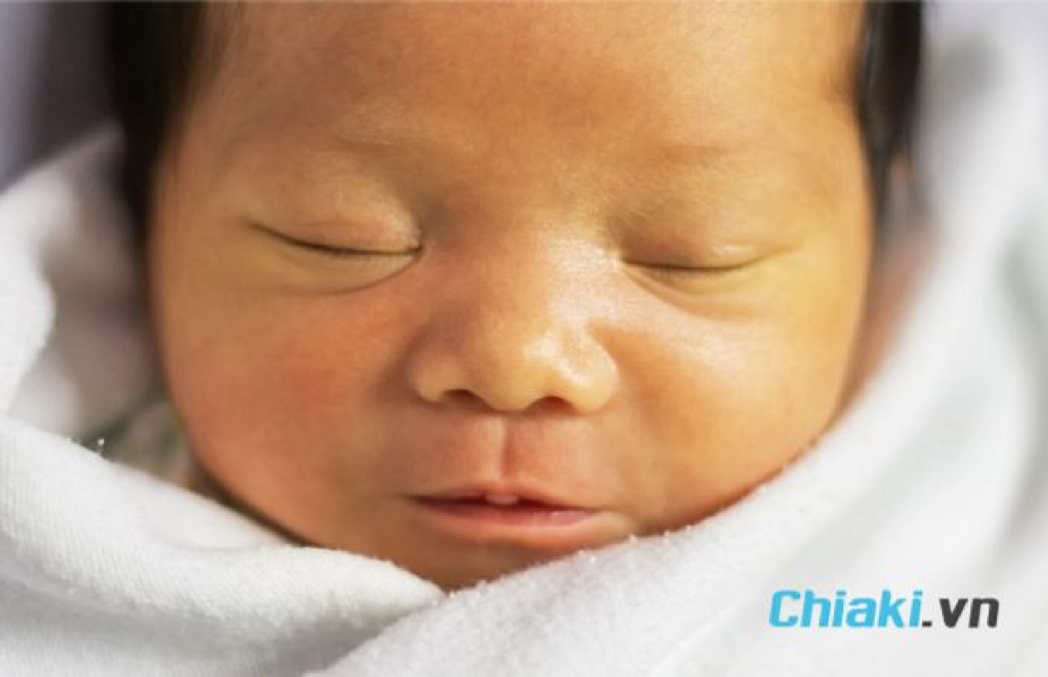C&aacute;ch chăm s&oacute;c trẻ sơ sinh bị v&agrave;ng da