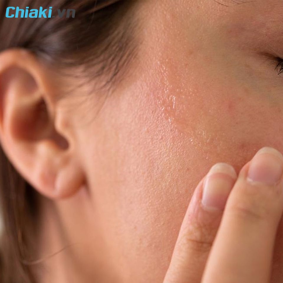 Một số kem chống nắng c&oacute; thể g&acirc;y kh&ocirc; da, căng r&aacute;t