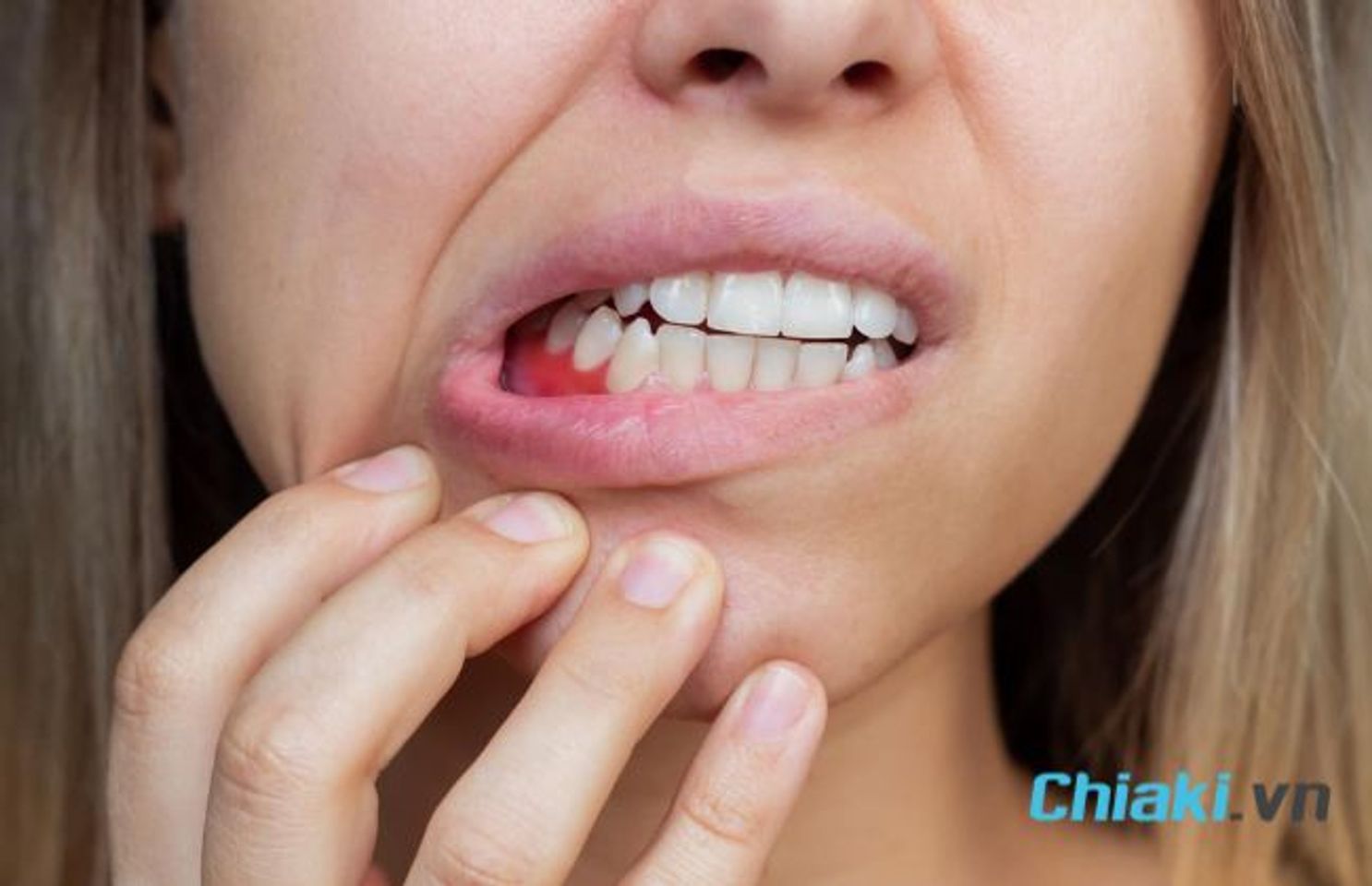 N&ecirc;n l&agrave;m g&igrave; khi bị chảy m&aacute;u ch&acirc;n răng