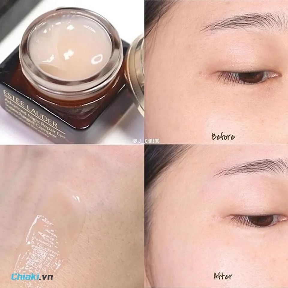 Quầng th&acirc;m mắt được cải thiện kh&aacute; r&otilde; rệt sau khi d&ugrave;ng kem mắt Estee Lauder