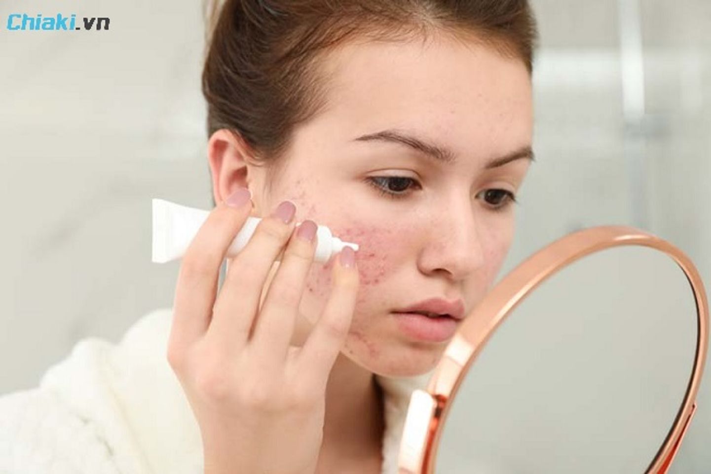 Kem trị sẹo rỗ chứa Ceramide v&agrave; Hyaluronic Acid hỗ trợ phục hồi da