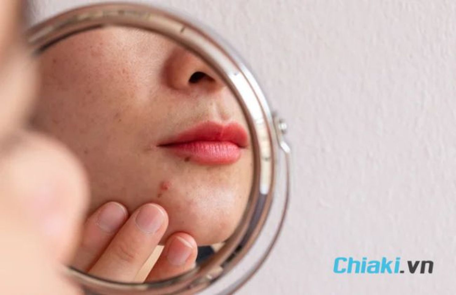 Tại sao d&ugrave;ng serum B5 bị nổi mụn