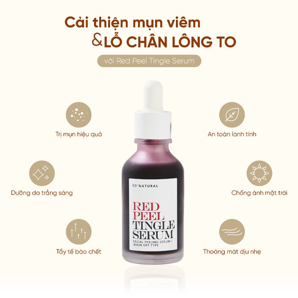 Tinh Chất So'Natural Làm Giảm Mụn, Tái Tạo Làn Da Red Peel Tingle Serum Facial Peeling Serum Chiaki.vn