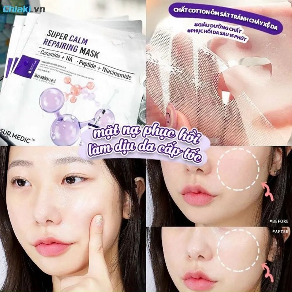 Ti&ecirc;u ch&iacute; quan trọng khi chọn mặt nạ Sur.Medic ph&ugrave; hợp