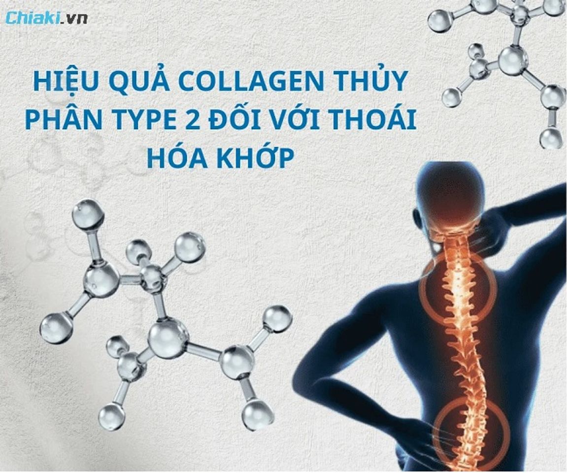 Collagen type II c&oacute; thể giảm tiến triển tổn thương sụn v&agrave; l&agrave;m chậm qu&aacute; tr&igrave;nh tho&aacute;i h&oacute;a