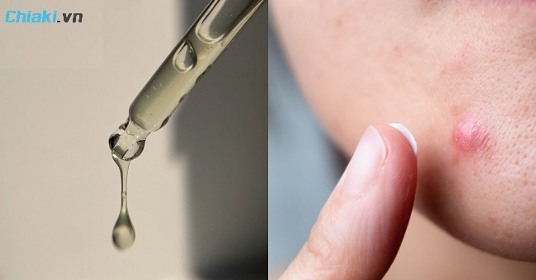 Nam giới n&ecirc;n lựa chọn c&aacute;c d&ograve;ng serum hoặc tinh chất đặc trị nhằm hỗ trợ cải thiện l&agrave;n da