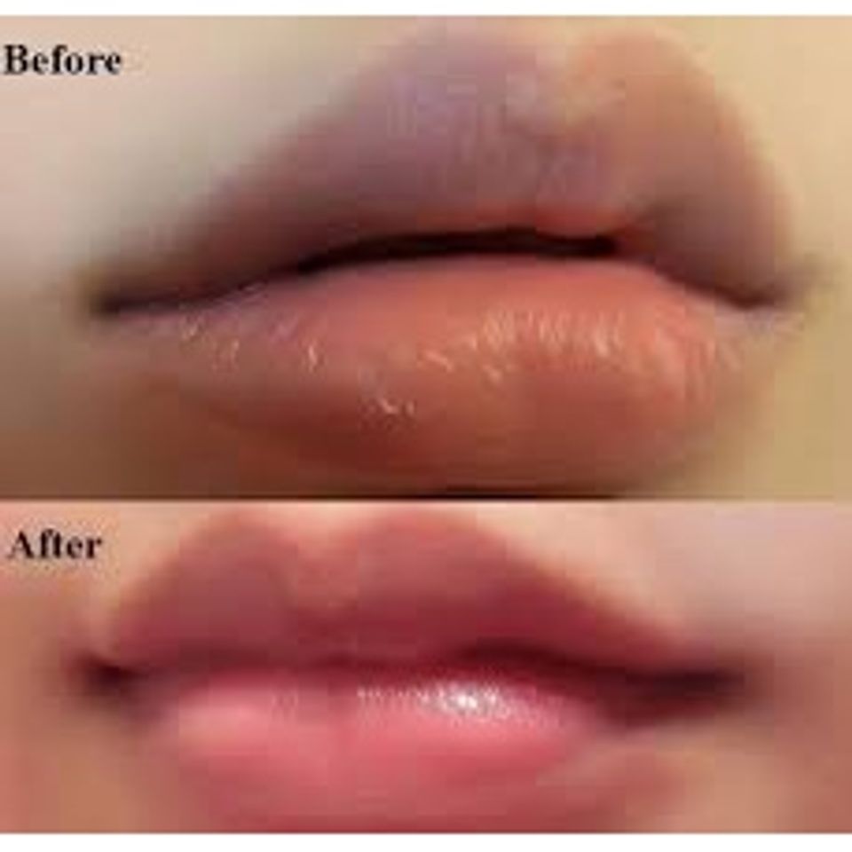 Dưỡng Môi Collagen Thiên Di - Khử Thâm & Làm Hồng Môi Tự Nhiên, Mềm Mịn, Không Hương Liệu, Dinh Dưỡng Từ Tinh Dầu Thiên Nhiên