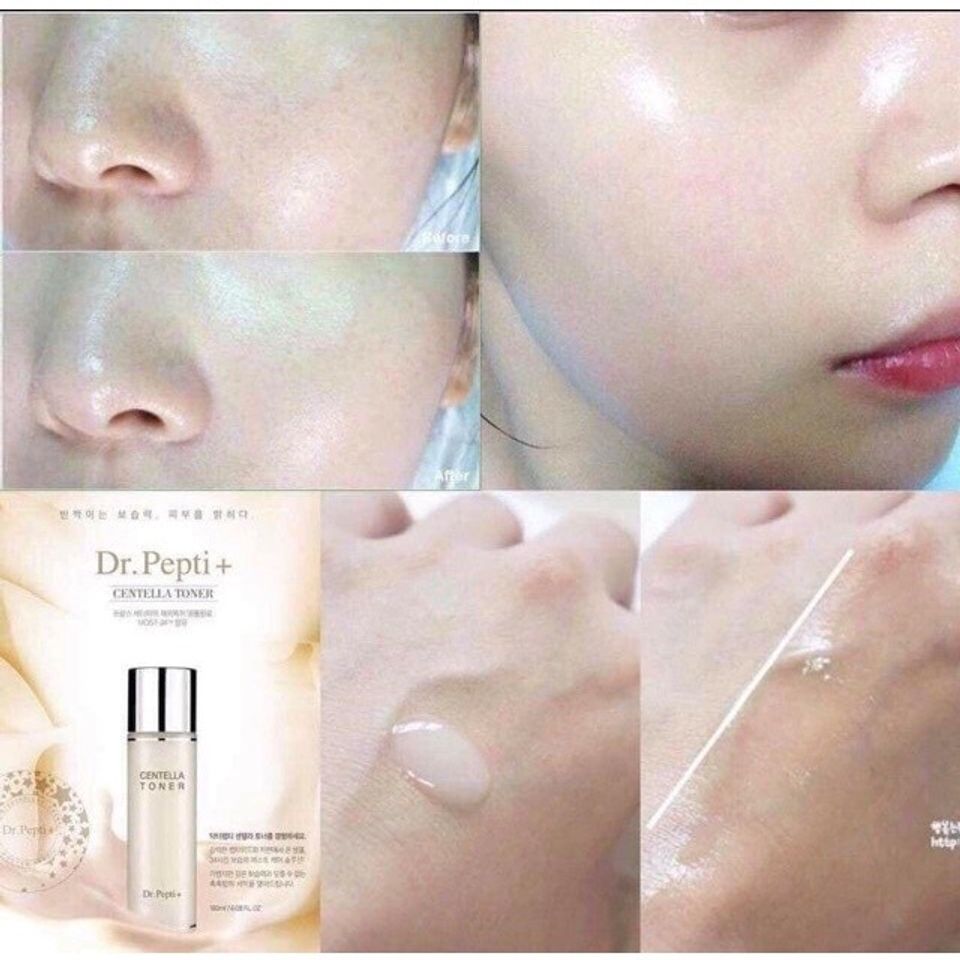 Nước Hoa Hồng Centella Dr.Pepti Ex Hàn Quốc Mẫu Mới 180ml Cấp Ẩm Căng Bóng Da