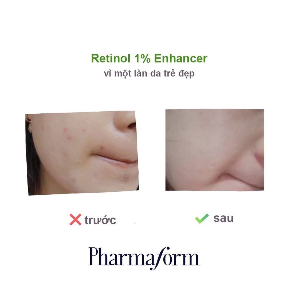 Tinh chất Retinol 1% Enhancer Pharmaform 15ml/20ml