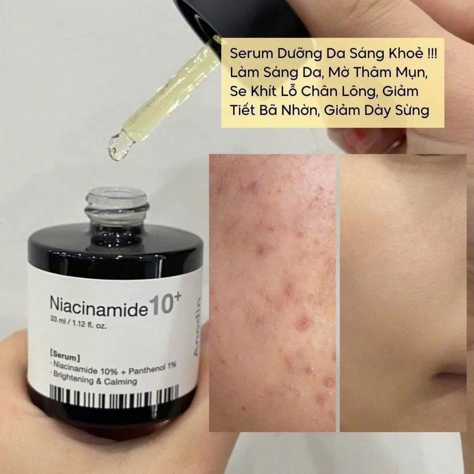 [Chính hãng] Tinh chất dưỡng trắng và mờ thâm Anodin Niacinamide 10 Plus 33ml