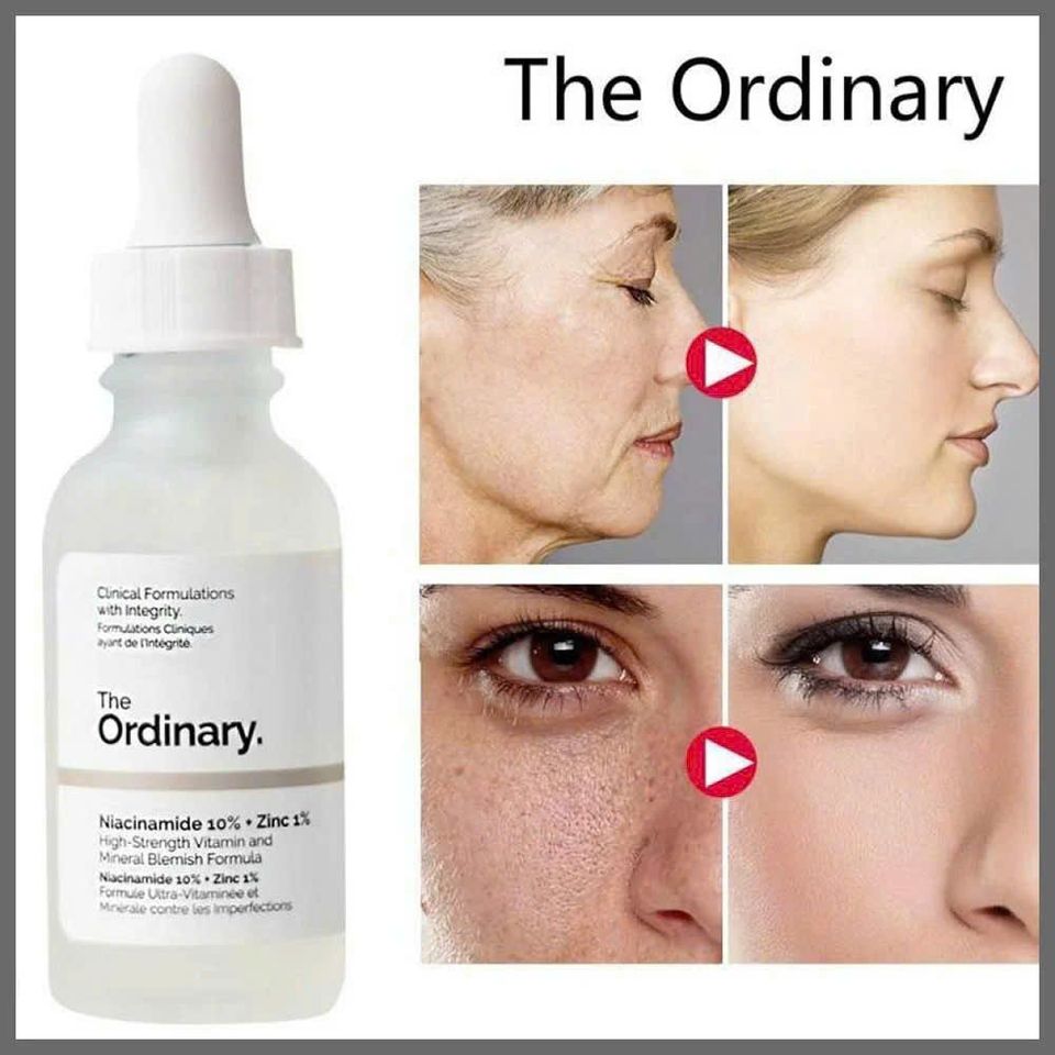 Tinh Chất Serum Giảm Mụn The Ordinary Niacinamide 10% & Zinc 1% - Kiềm Dầu, Làm Sáng Da, 30ml