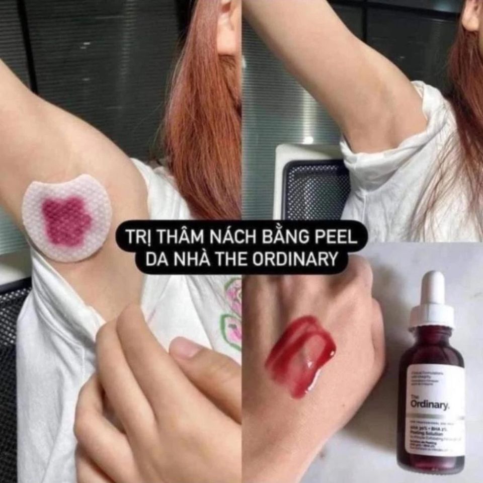 Tinh Chất Serum Tẩy Tế Bào Chết The Ordinary AHA 30% + BHA 2% 30ml - Giải Pháp Làm Sáng Da, Cải Thiện Mụn, Se Khít Lỗ Chân Lông