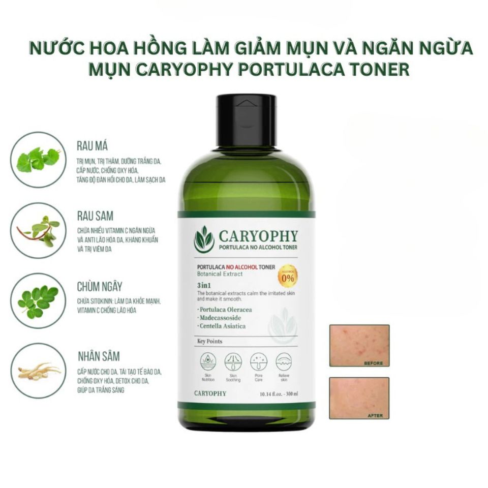 Nước Hoa Hồng Caryophy Portulaca Toner 300ml - Giảm Mụn, Làm Dịu Da, Cân Bằng pH - Dưỡng Da Từ Thiên Nhiên Hàn Quốc