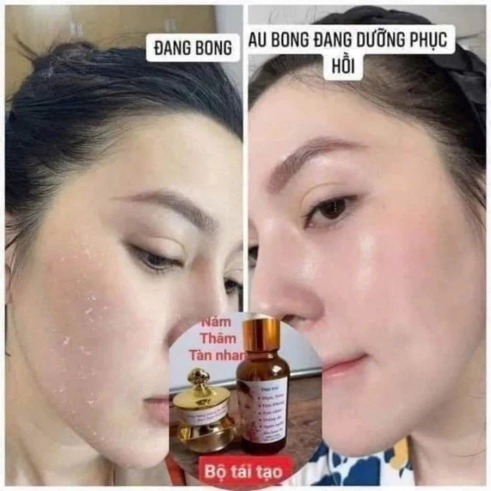 Combo Kem Face và Serum Tái Tạo Da Gia Truyền - Giúp Da Căng Bóng Mịn Màng, Khắc Phục Nám Mụn Tàn Nhang Chuyên Sâu