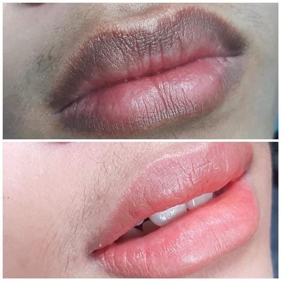Combo Dưỡng Môi Collagen Thiên Di - Cấy Hồng Môi Giảm Thâm, Tự Nhiên Không Cần Phun Xăm, Mềm Mịn  - Làm Đẹp Da Môi