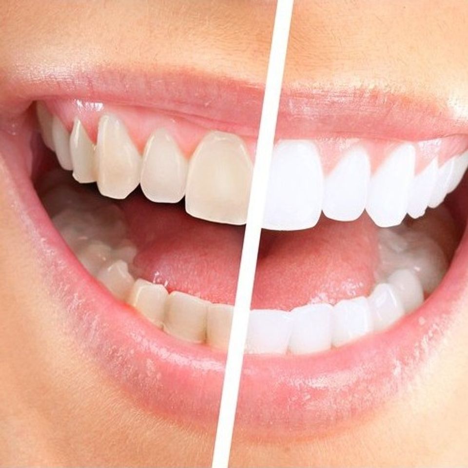 Kem Đánh Răng Ajona Đức 25ml - Giảm Hôi Miệng, Làm Sạch Sâu, Bảo Vệ Nướu, Dành Cho Người Uống Trà Cà Phê