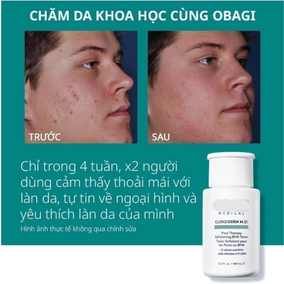 Toner BHA Obagi Clenziderm Pore Therapy 2% Salicylic Acid 148ml - Giảm Mụn, Làm Sạch Sâu, Chăm Sóc Da Dầu và Da Mụn