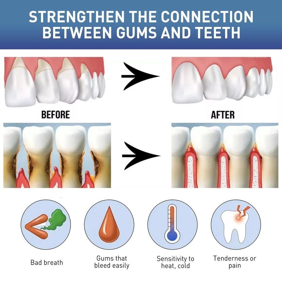 Bút Tẩy Trắng Răng Nha Khoa TEETH Whitening Pen - Giúp Làm Sạch Mảng Bám, Răng Trắng Sáng Tự Nhiên, Tiện Lợi và An Toàn