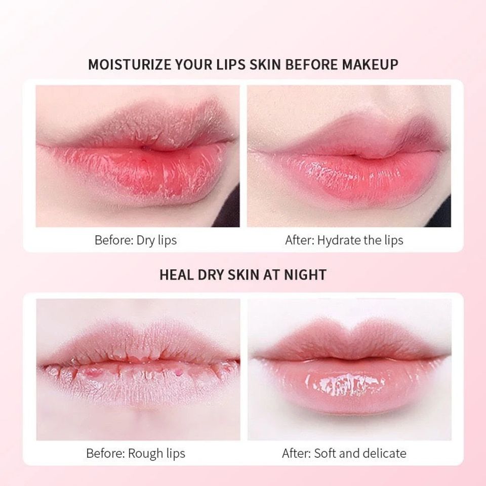 Dưỡng Hồng Môi KORMESIC 15ML – Mặt Nạ Ngủ Môi Lip Mask Dưỡng Ẩm, Làm Hồng Môi, Giúp Môi Mềm Mại và Tươi Sáng