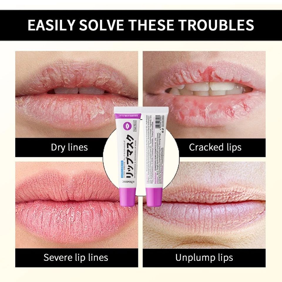 Dưỡng Hồng Môi KORMESIC 15ML – Mặt Nạ Ngủ Môi Lip Mask Dưỡng Ẩm, Làm Hồng Môi, Giúp Môi Mềm Mại và Tươi Sáng