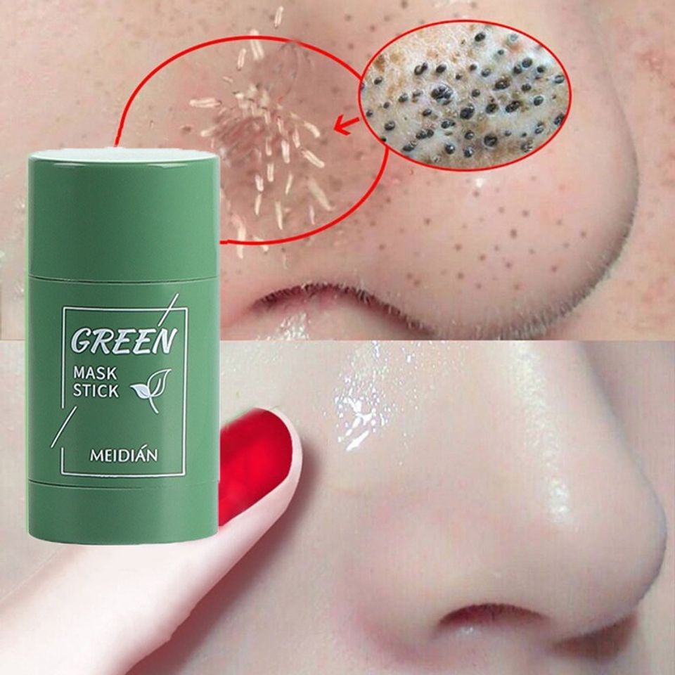 Mặt Nạ Bùn Trà Xanh Dưỡng Ẩm Kiềm Dầu dạng thỏi Meidian - Sản phẩm chăm sóc da cao cấp, tự nhiên, sạch sẽ, tươi mới cho 