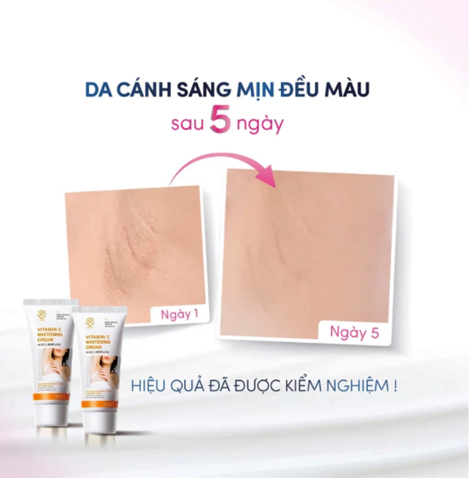 Kem Trắng Nách Gongpei - Kem Giảm Thâm, Khử Mùi Hôi Nách Hàn Quốc Chất lượng, Sáng Da Hiệu Quả 60g