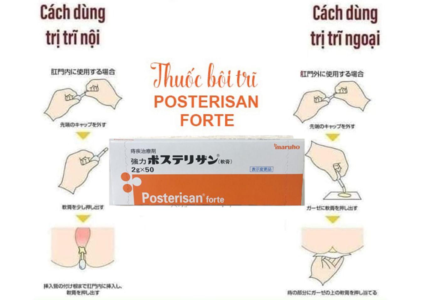 Kem Bôi Trĩ Nhật Bản Posterisan Forte - Giảm Đau Rát, Chăm Sóc Da Hậu Môn - Hộp 50 Tuýp Tiện Lợi
