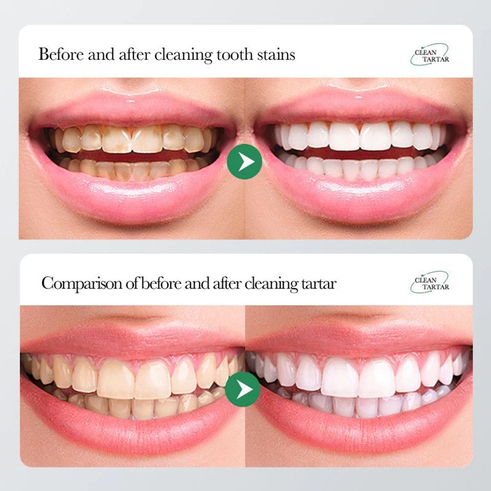 Kem Đánh Răng Baking Soda Toothpaste 100g - Làm Trắng Răng, Loại Bỏ Cao Răng, Hơi Thở Thơm Mát, Chăm Sóc Sức Khỏe Răng Miệng