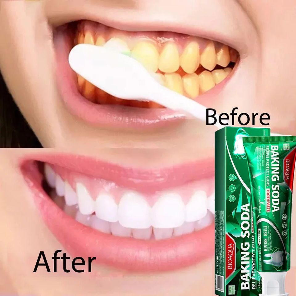 Kem Đánh Răng Baking Soda Toothpaste 100g - Làm Trắng Răng, Loại Bỏ Cao Răng, Hơi Thở Thơm Mát, Chăm Sóc Sức Khỏe Răng Miệng