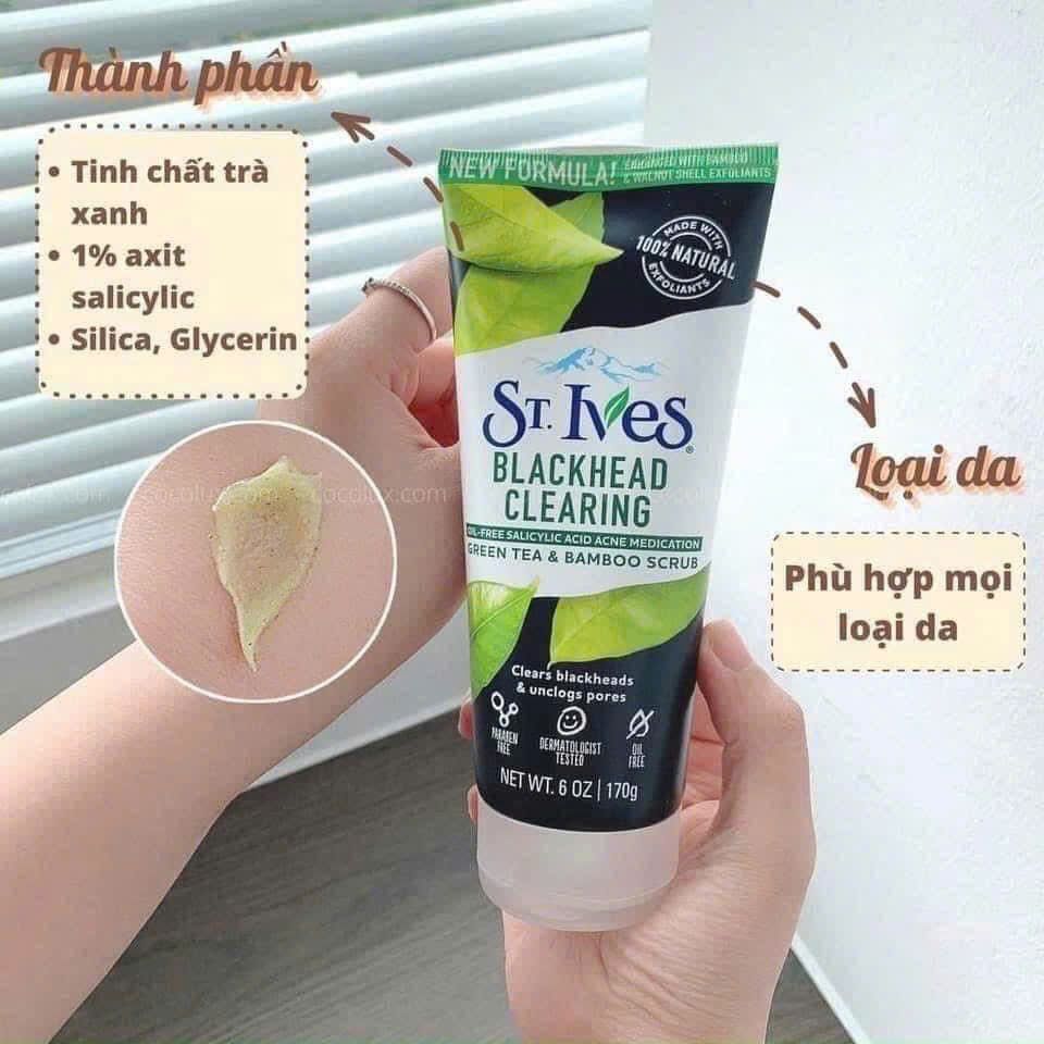 Sữa Rửa Mặt St.Ives Trà Xanh 170g - Loại Bỏ Mụn Đầu Đen, Làm Dịu Da, Chăm Sóc Da Hàng Ngày