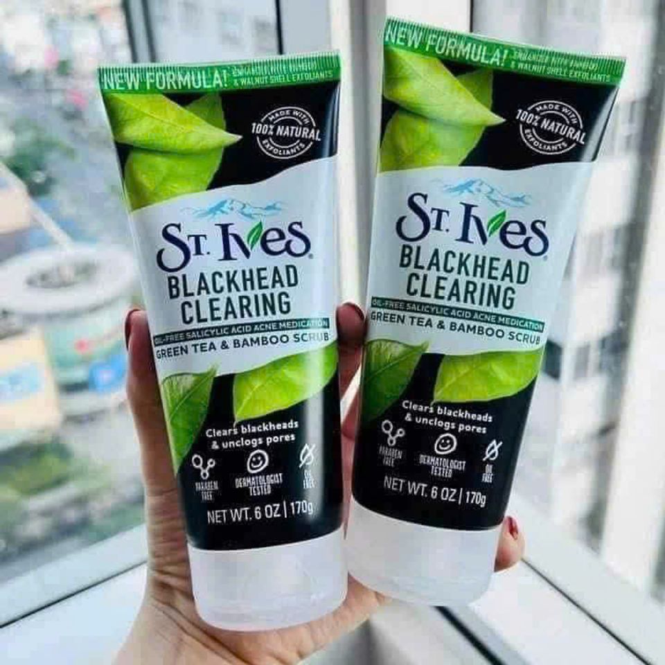 Sữa Rửa Mặt St.Ives Trà Xanh 170g - Loại Bỏ Mụn Đầu Đen, Làm Dịu Da, Chăm Sóc Da Hàng Ngày