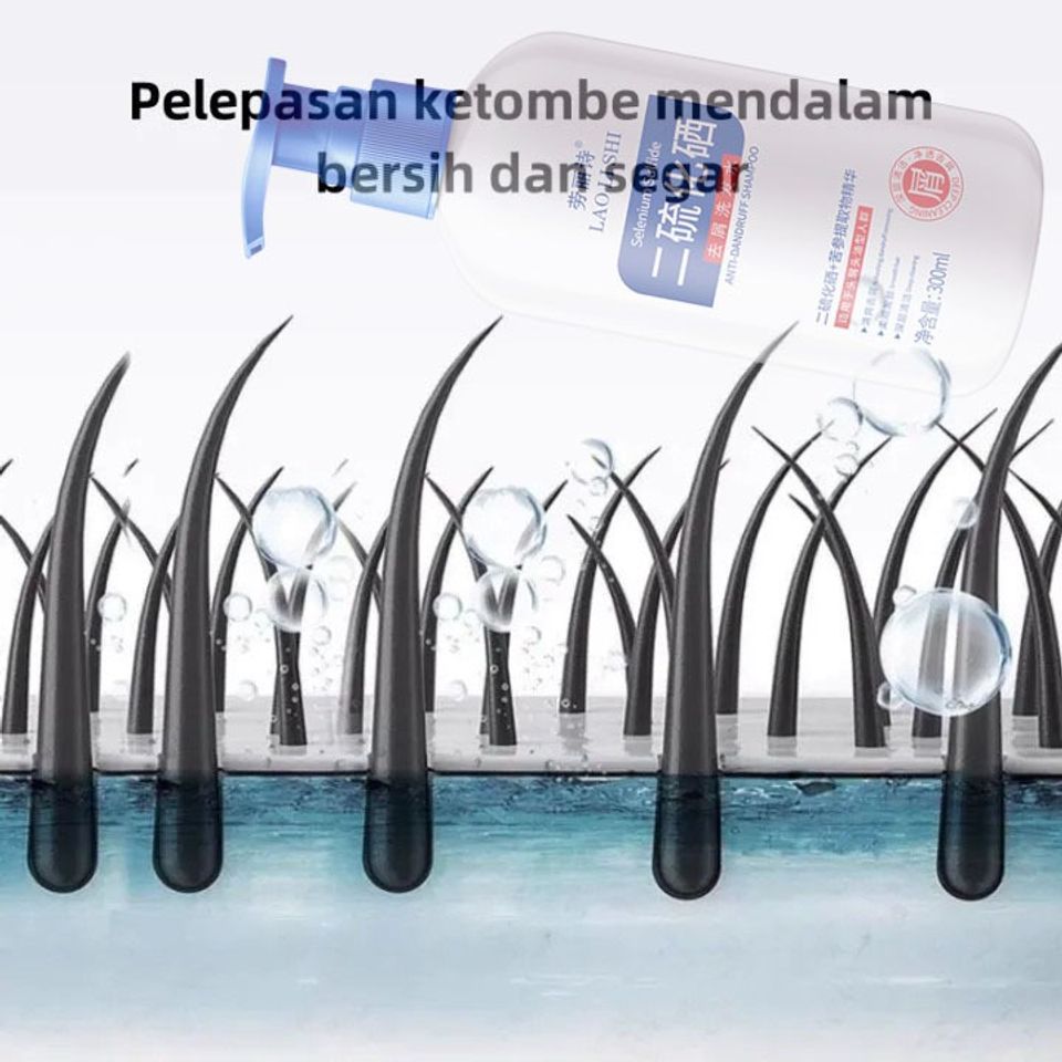 Dầu gội sạch gàu Dầu Gội gội loại bỏ mạt dầu gội giảm ngứa 300ml Làm sạch sâu da đầu, loại bỏ ve, loại