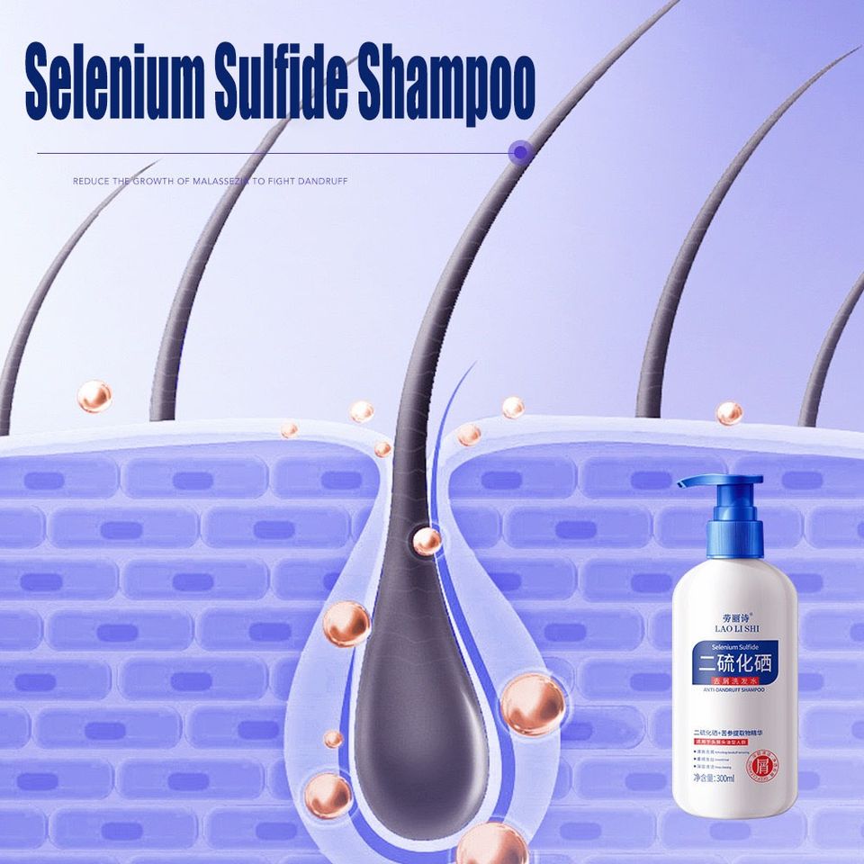 Dầu gội sạch gàu Dầu Gội gội loại bỏ mạt dầu gội giảm ngứa 300ml Làm sạch sâu da đầu, loại bỏ ve, loại