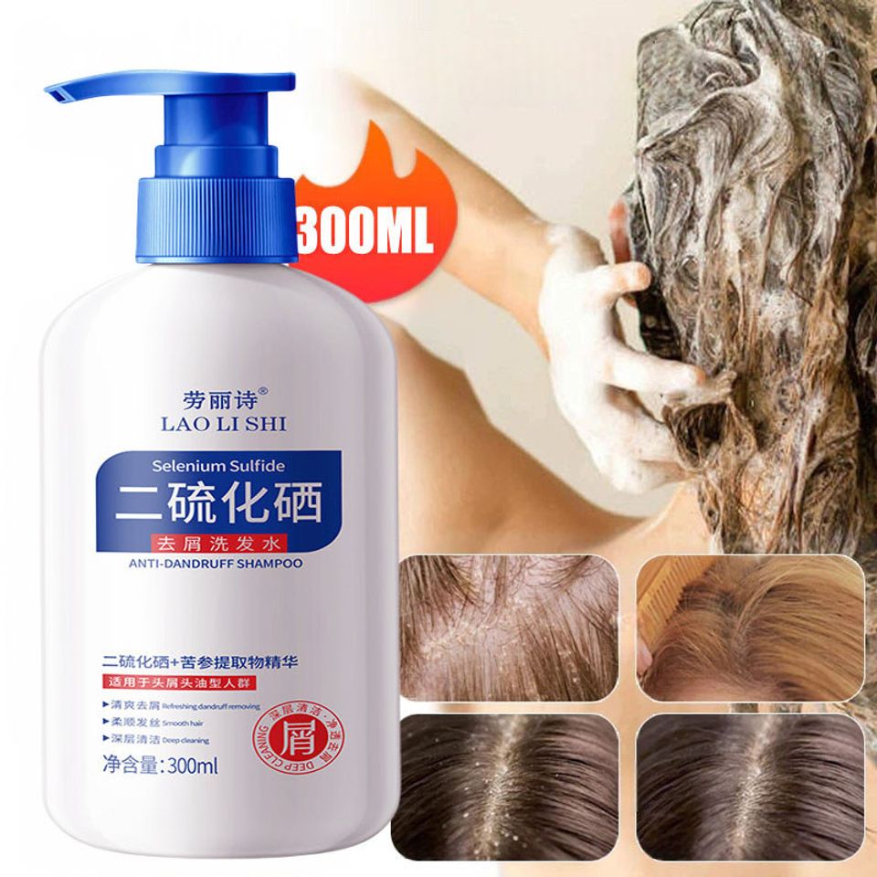 Dầu gội sạch gàu Dầu Gội gội loại bỏ mạt dầu gội giảm ngứa 300ml Làm sạch sâu da đầu, loại bỏ ve, loại