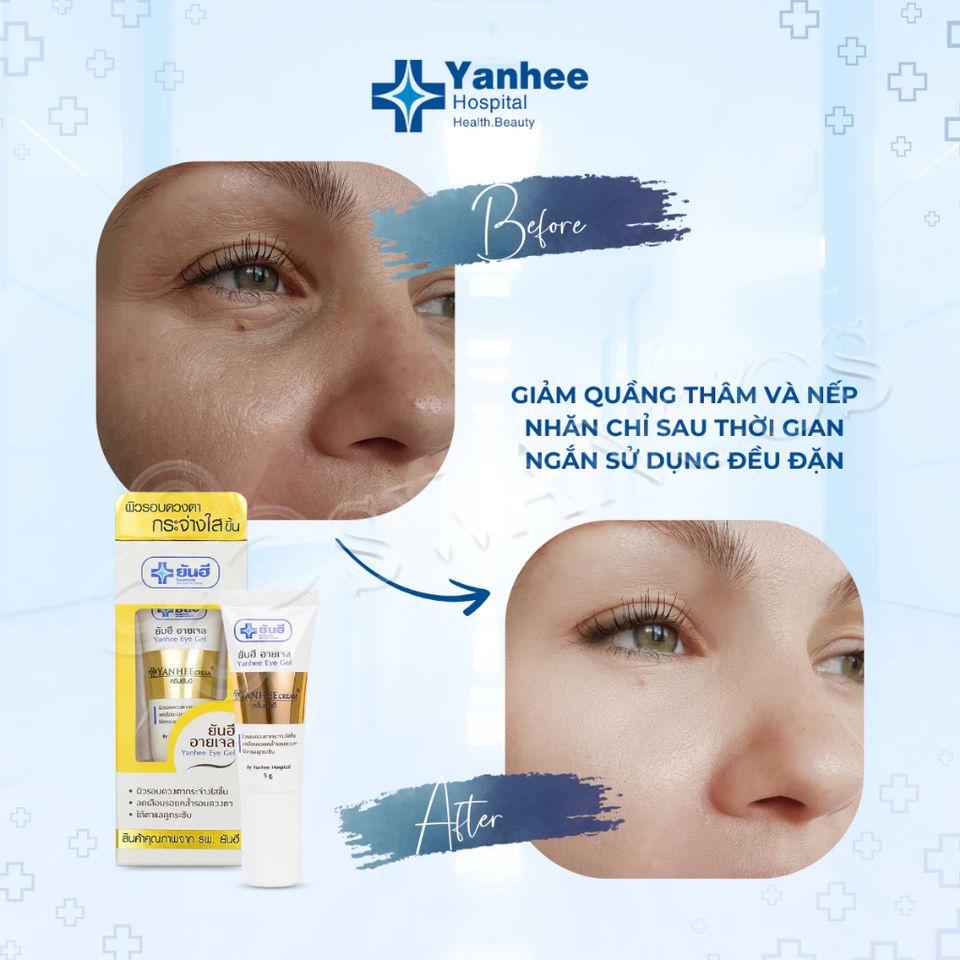 Kem Thâm Mắt, bọng mắt Yanhee Eye Gel Thái Lan Cao Cấp Kem Dưỡng Mắt Loại Bỏ Quầng Thâm Bọng Mắt Chống Lão Hóa