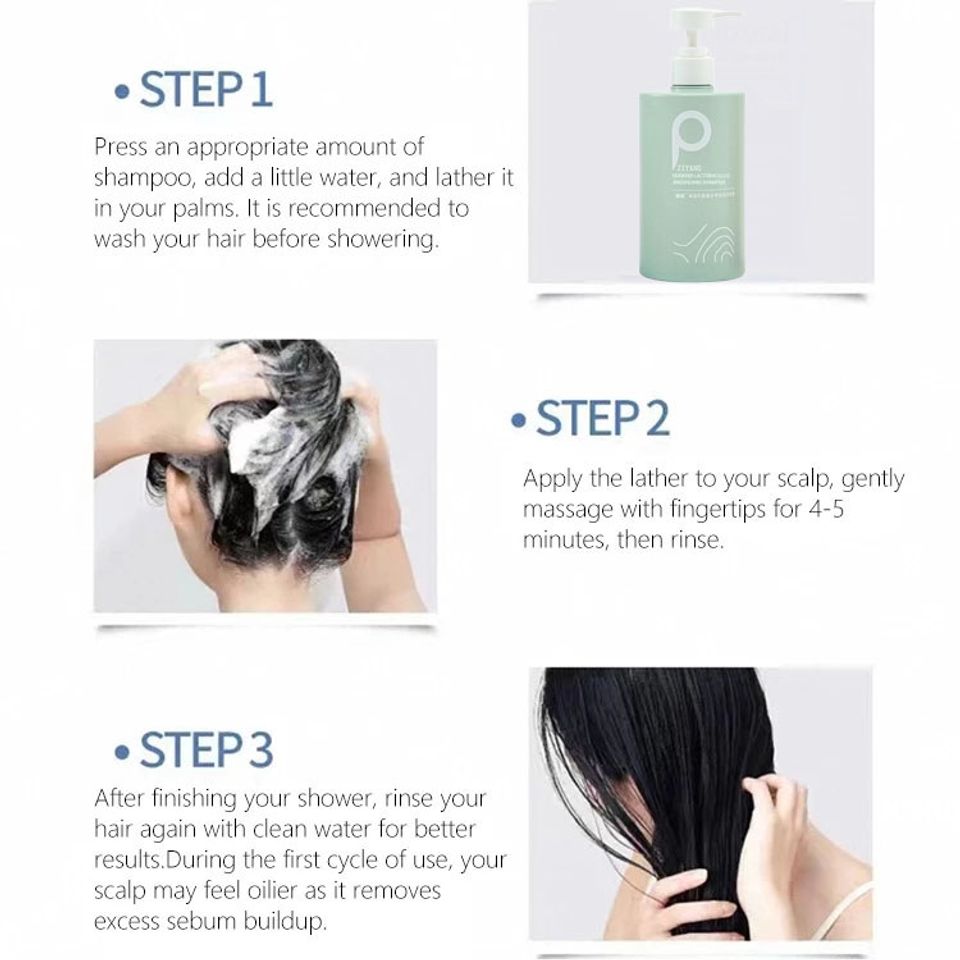 Dầu gội bôi da dứtt điểmm nấm da đầu, viêm da, vảy nến/Shampoo
