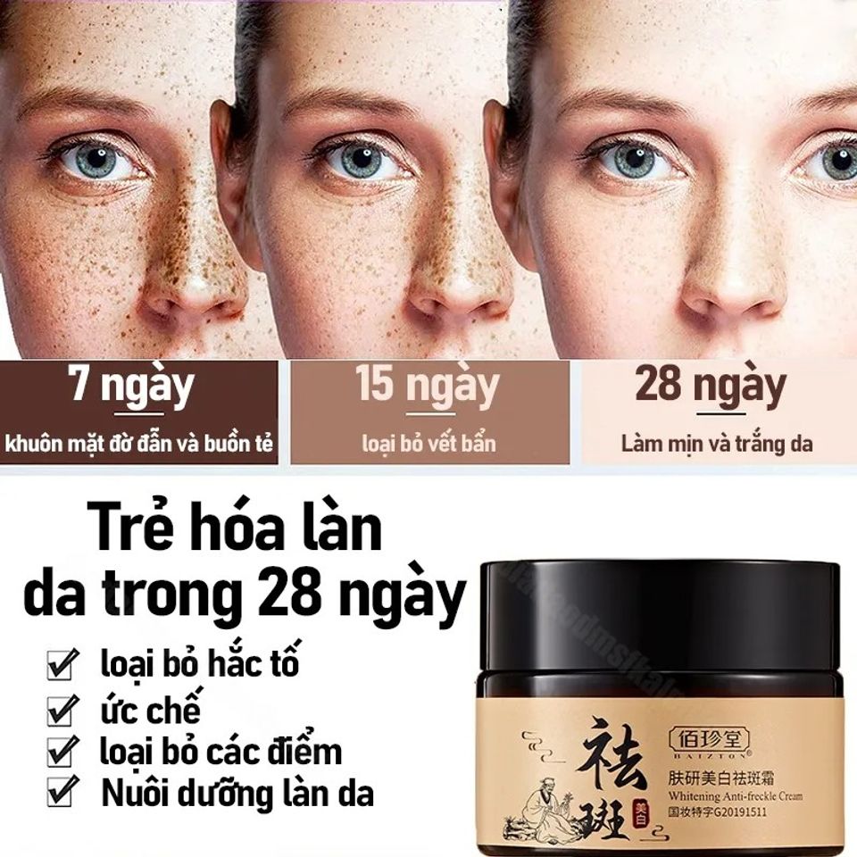 Kem nám tàn nhang chấm tàn nhang kem trắng da mặt 30g Loại bỏ nám tàn nhang làm trắng sáng da dưỡng ẩm da