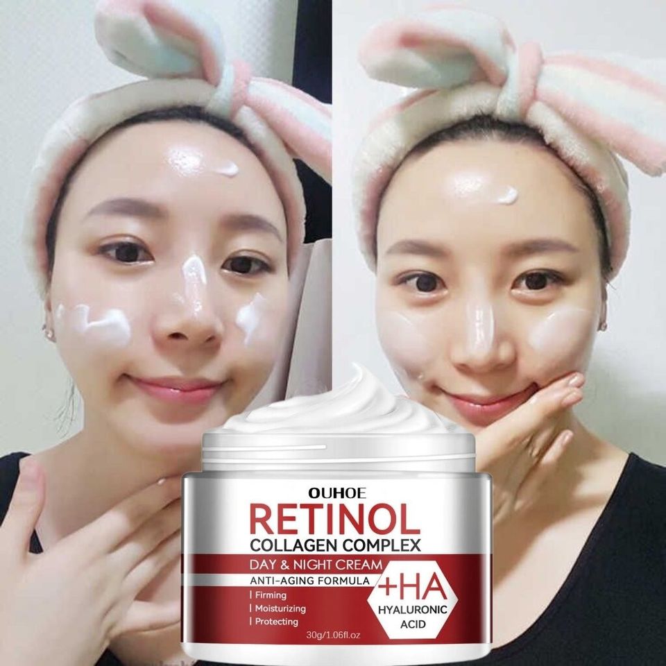 Kem dưỡng Retinol Kem nám tàn nhang chấm tàn nhang kem trắng da mặt 30g Loại bỏ nám tàn nhang làm trắng sáng da dưỡng ẩm