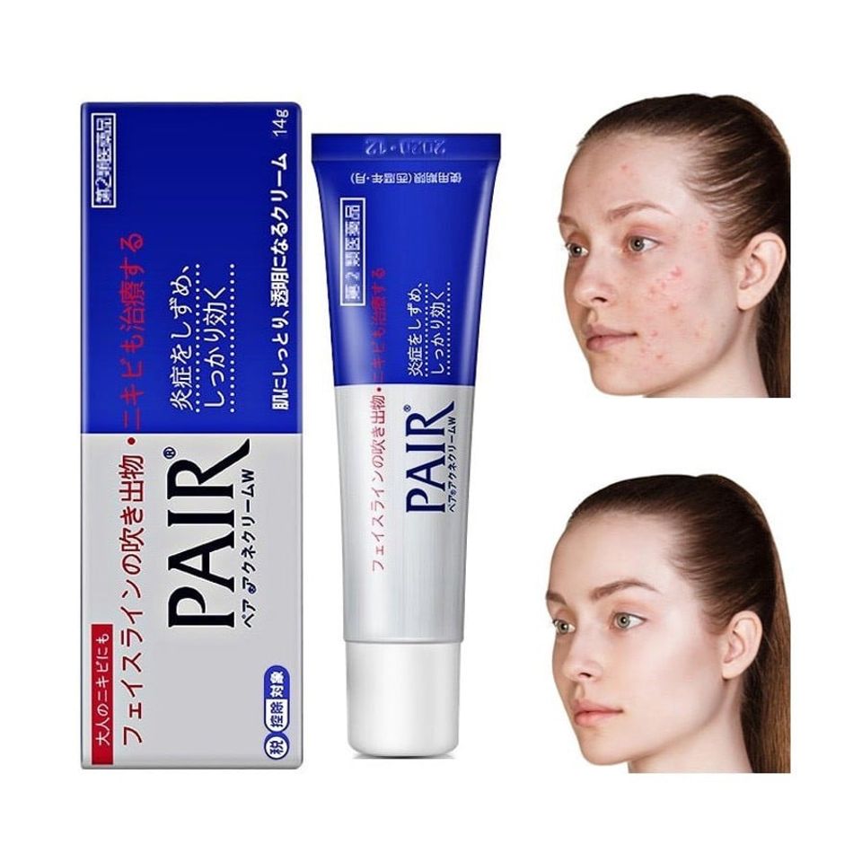 Kem Làm Sạch  Mụn  Pair Nhật Bản 14g